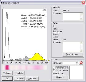 TurboScan Densitometer Software